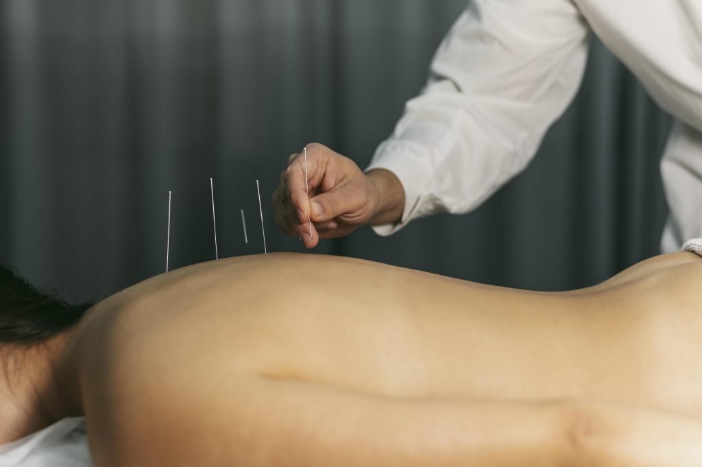 Acupuncturist in gorinchem